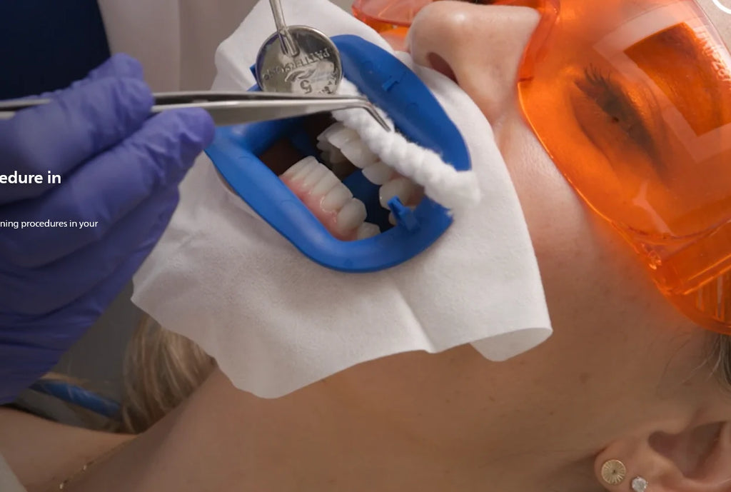 2 Person Complete Procedures Teeth Whitening Kit C9726