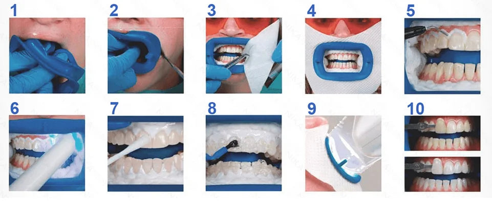 2 Person Complete Procedures Teeth Whitening Kit C9726